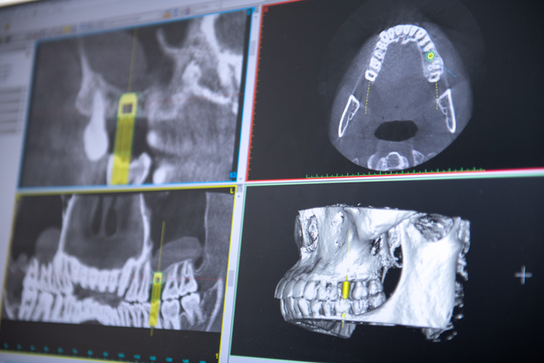 合同会社アマプロ：歯医者撮影（2023/03/10）の事例写真